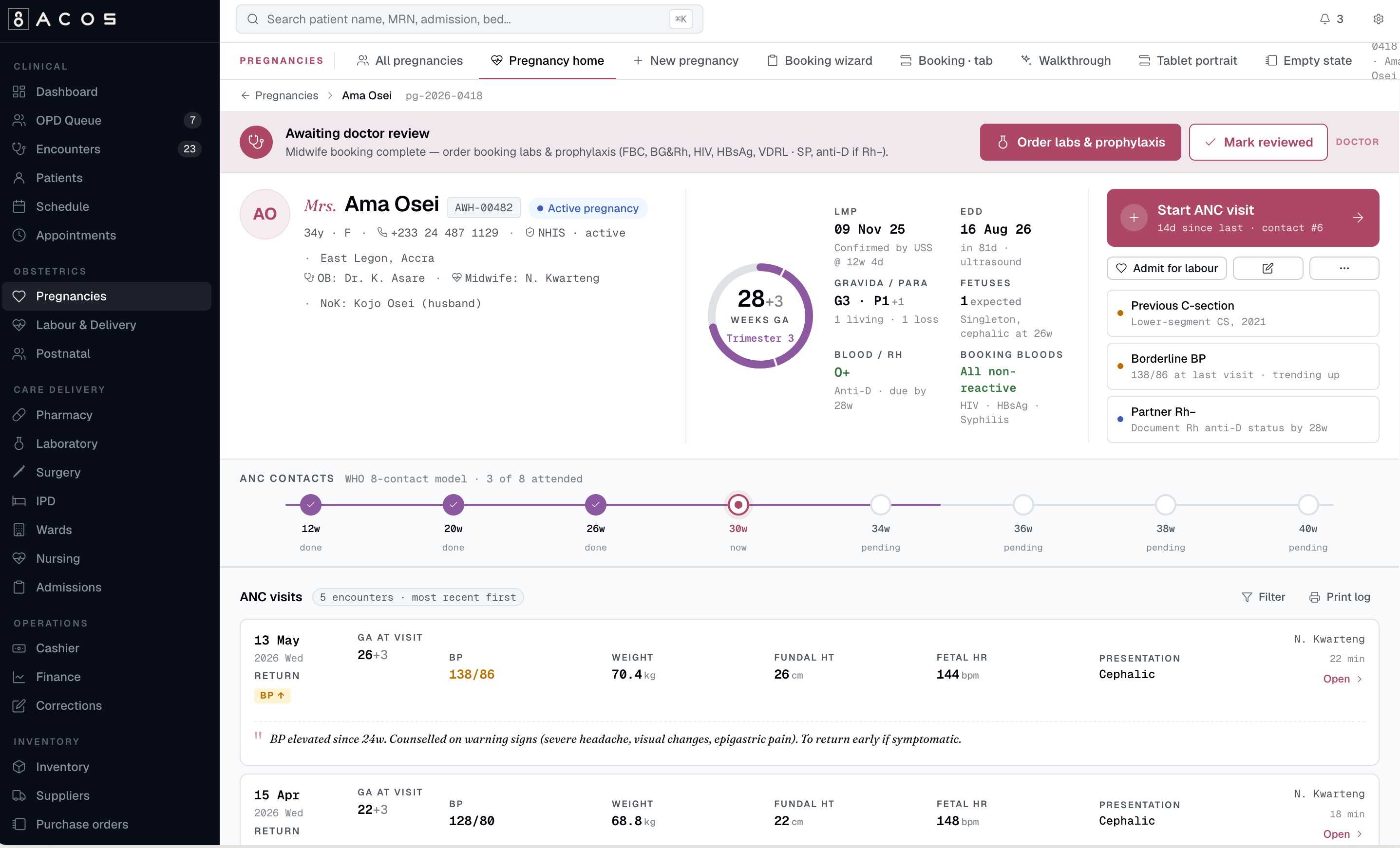 The ACOS labour ward board — every mother in labour with dilation, fetal heart rate and blood pressure, sorted by attention need with severe alerts flagged
